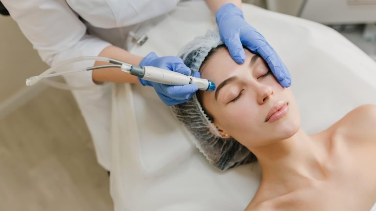 Microneedling con Demapen en La Boutique Del Cabello 2
